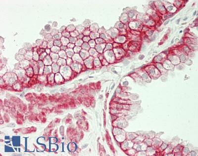 CTNND1 / p120 Catenin Antibody - Human Prostate: Formalin-Fixed, Paraffin-Embedded (FFPE)
