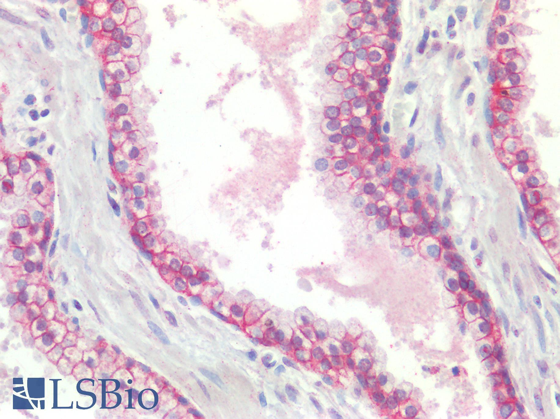 CTNND1 / p120 Catenin Antibody - Human Prostate: Formalin-Fixed, Paraffin-Embedded (FFPE)