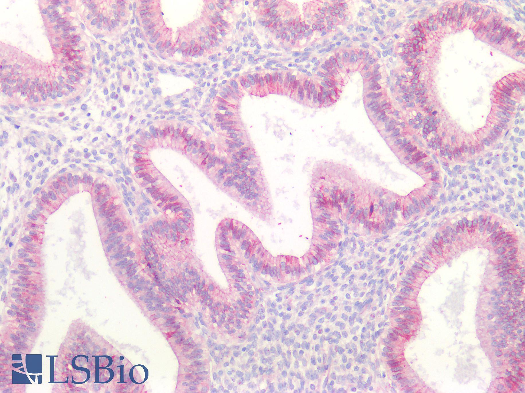 CTNND1 / p120 Catenin Antibody - Human Uterus: Formalin-Fixed, Paraffin-Embedded (FFPE)