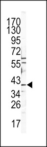 CTSB / Cathepsin B Antibody - Western blot of CATB Antibody in Y79 cell line lysates (35 ug/lane). CATB (arrow) was detected using the purified antibody.