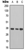 CTSB / Cathepsin B Antibody - Western blot analysis of Cathepsin B expression in A549 (A); HT1080 (B); mouse heart (C) whole cell lysates.