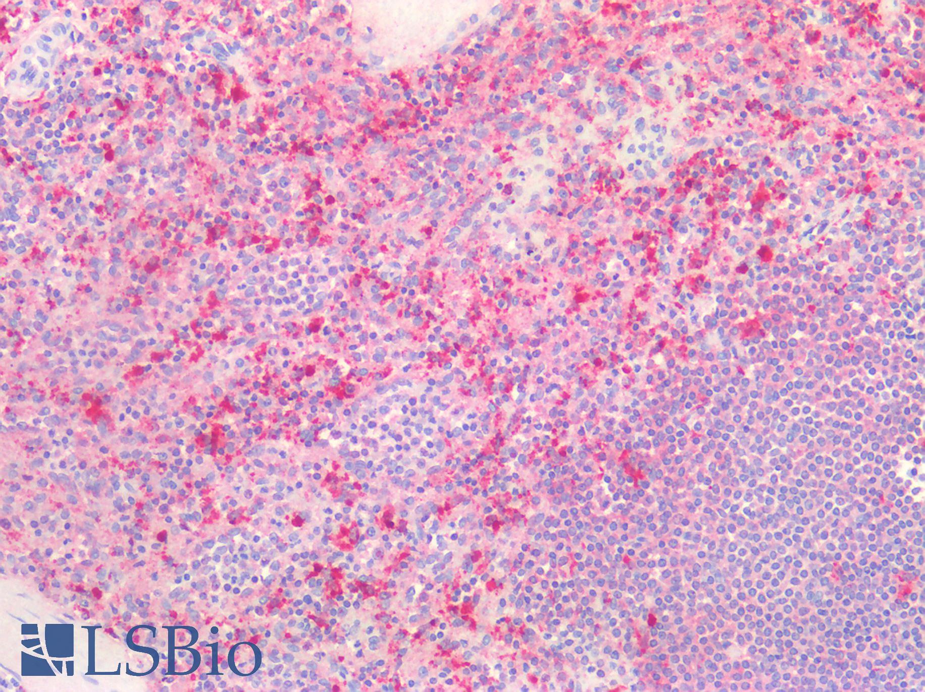 CTSB / Cathepsin B Antibody - Human Spleen: Formalin-Fixed, Paraffin-Embedded (FFPE)