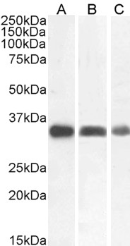 CTSB / Cathepsin B Antibody - Staining of Human Lung (A) and HCORC (B) and (0.5ug/ml) HCBGLC (C) lysate (35µg protein in RIPA buffer). Detected by chemiluminescence.