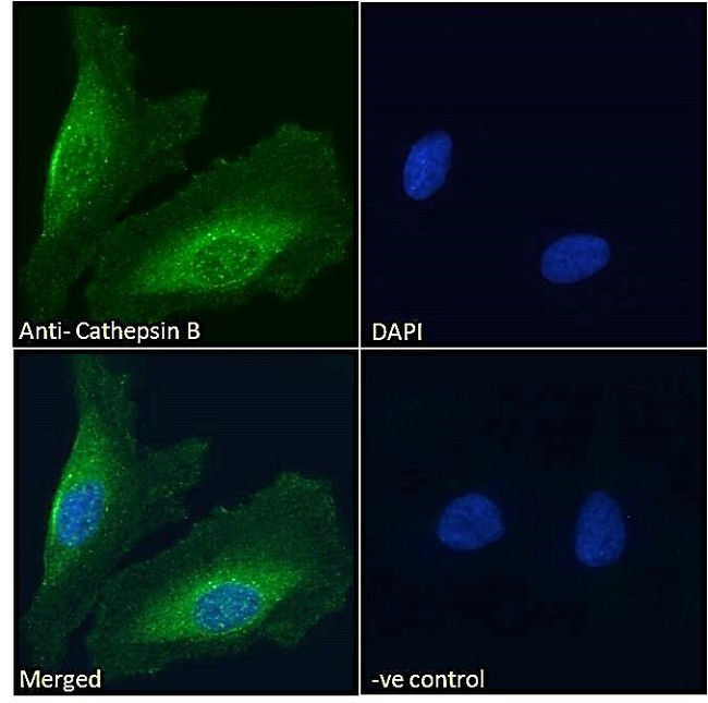 CTSB / Cathepsin B Antibody - Immunofluorescence analysis of paraformaldehyde fixed HeLa cells, permeabilized with 0.15% Triton. Primary incubation 1hr (10ug/ml) followed by Alexa Fluor 488 secondary antibody (2ug/ml), showing cytoplasmic/vesicle and extracellular staining. The nuclear stain is DAPI (blue). Negative control: Unimmunized goat IgG (10ug/ml) followed by Alexa Fluor 488 secondary antibody (2ug/ml).