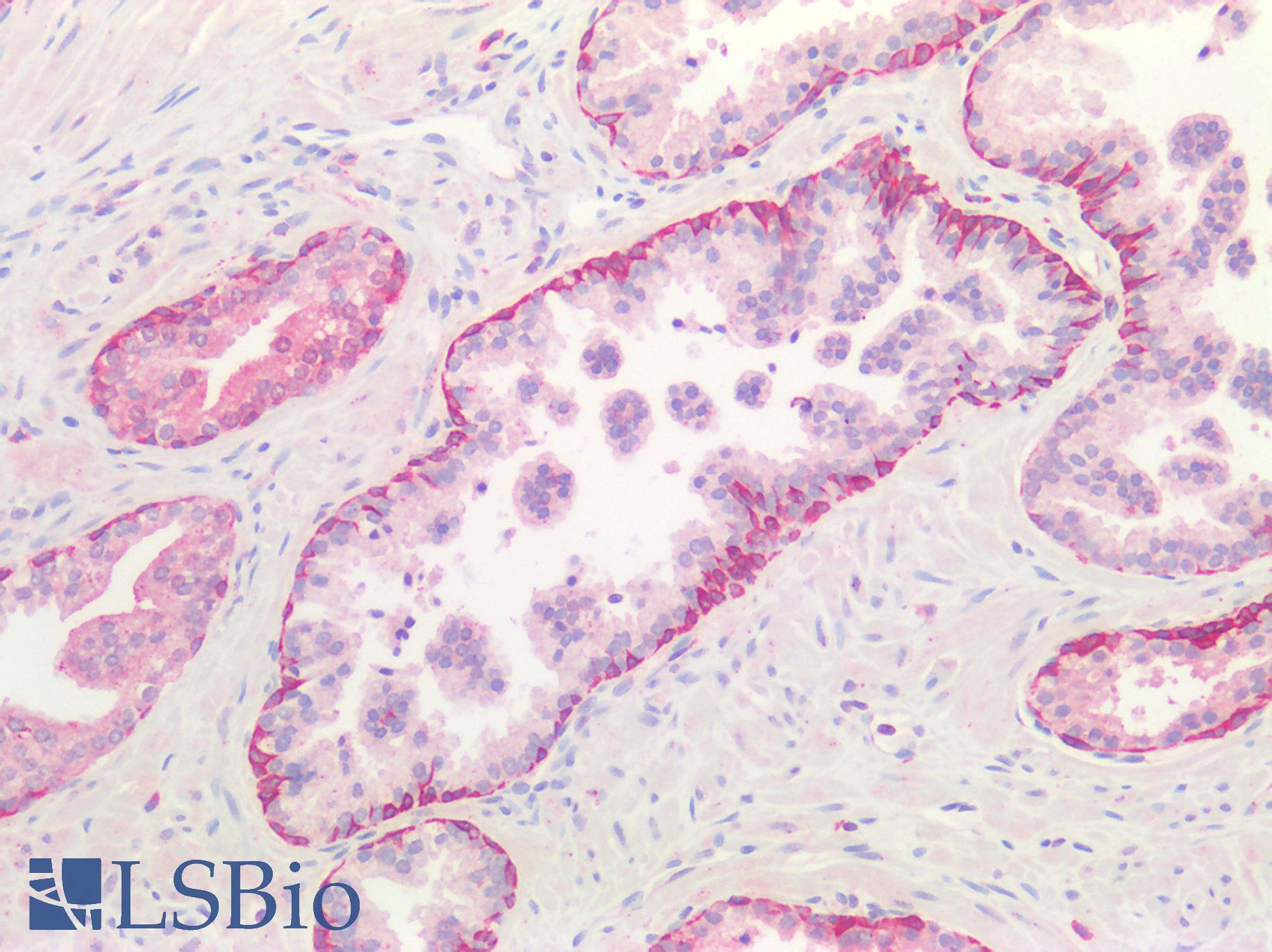 CTSB / Cathepsin B Antibody - Human Prostate: Formalin-Fixed, Paraffin-Embedded (FFPE)