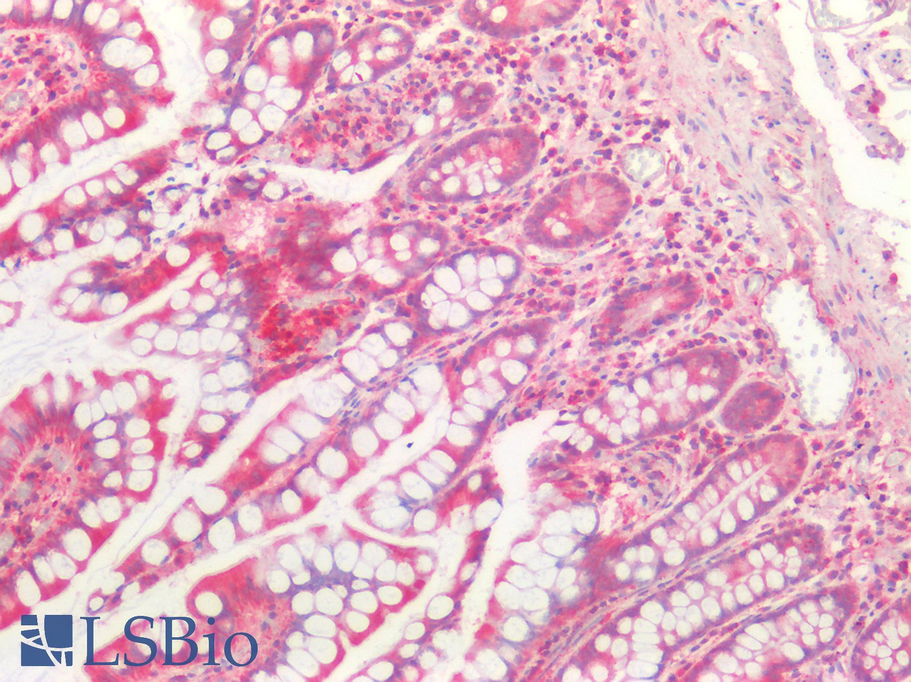 CTSB / Cathepsin B Antibody - Human Small Intestine: Formalin-Fixed, Paraffin-Embedded (FFPE)