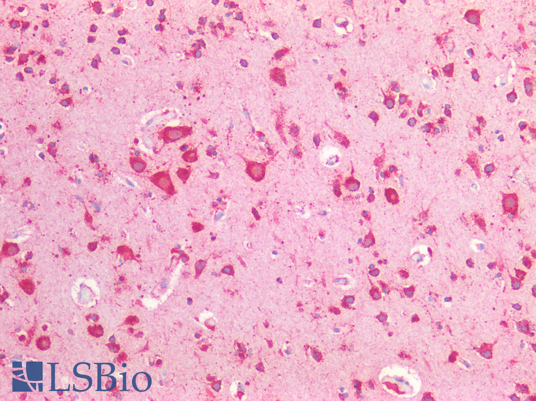 CTSD / Cathepsin D Antibody - Human Brain, Cortex: Formalin-Fixed, Paraffin-Embedded (FFPE)