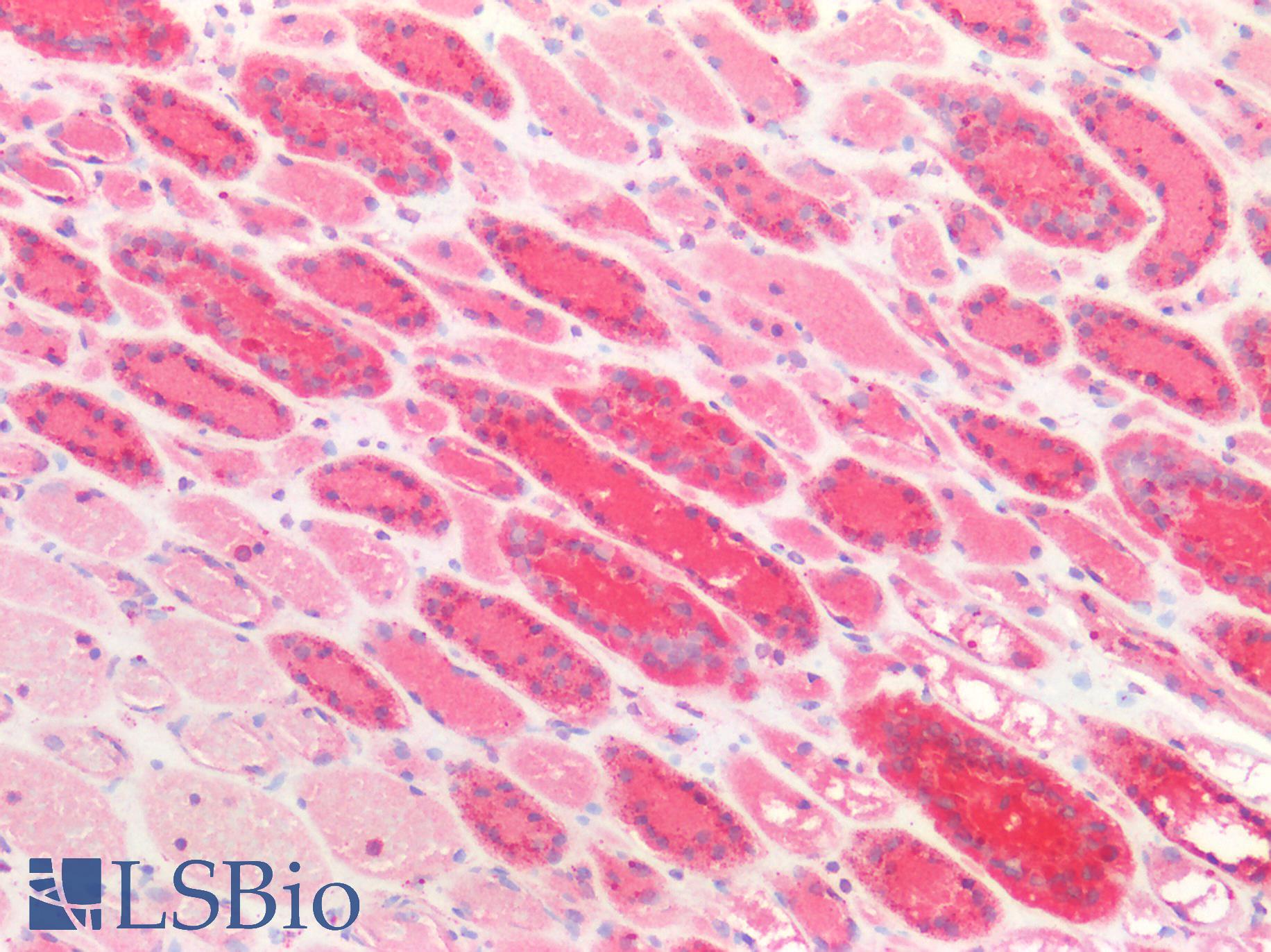 CTSD / Cathepsin D Antibody - Human Kidney: Formalin-Fixed, Paraffin-Embedded (FFPE)