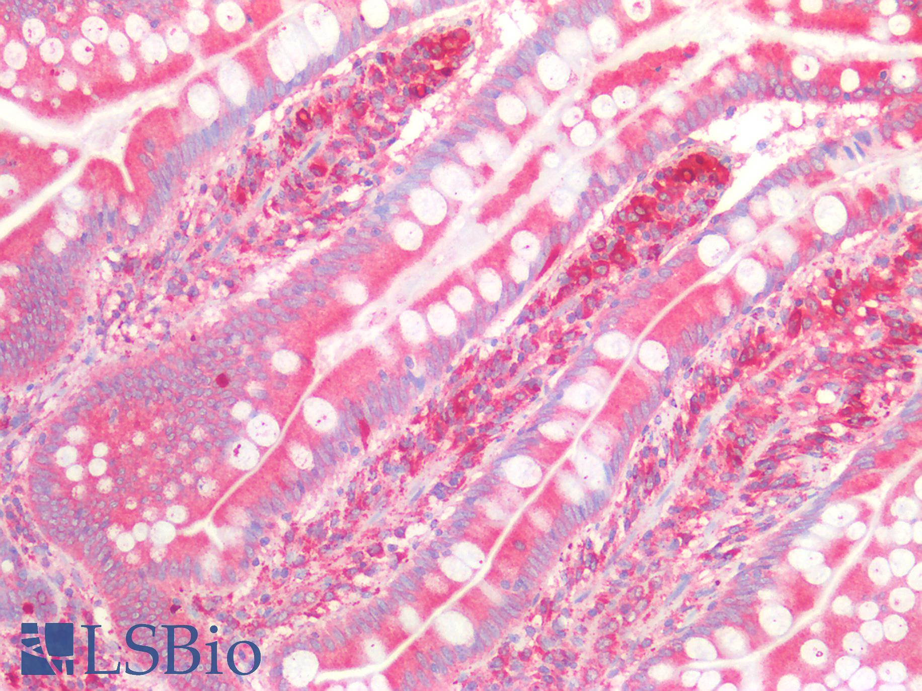 CTSD / Cathepsin D Antibody - Human Small Intestine: Formalin-Fixed, Paraffin-Embedded (FFPE)