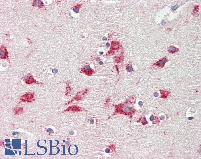 CTSD / Cathepsin D Antibody - Human Brain, Cortex: Formalin-Fixed, Paraffin-Embedded (FFPE).  This image was taken for the unconjugated form of this product. Other forms have not been tested.