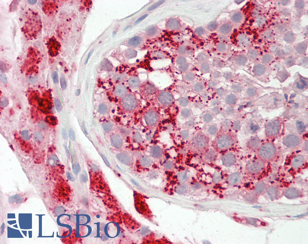 CTSD / Cathepsin D Antibody - Human Testis: Formalin-Fixed, Paraffin-Embedded (FFPE).  This image was taken for the unconjugated form of this product. Other forms have not been tested.