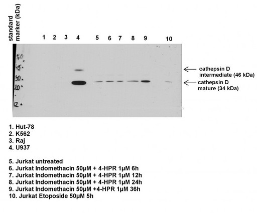 CTSD / Cathepsin D Antibody - Western blot analysis using Anti-CTSD / Cathepsin D Antibody (C-Terminus) at a 1ug/ml concentration.  This image was taken for the unconjugated form of this product. Other forms have not been tested.