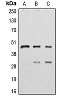 CTSD / Cathepsin D Antibody - Western blot analysis of Cathepsin D expression in HepG2 (A); MDAMB231 (B); MCF7 (C) whole cell lysates.