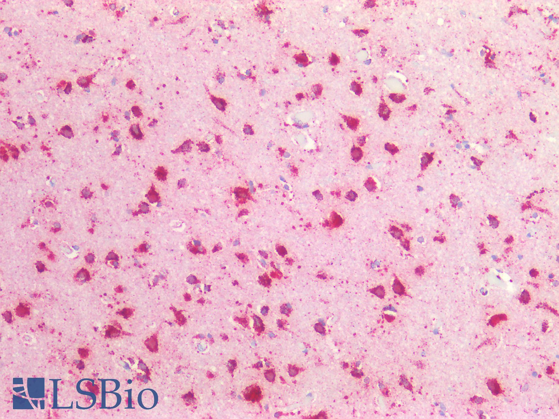 CTSD / Cathepsin D Antibody - Human Brain, Cortex: Formalin-Fixed, Paraffin-Embedded (FFPE)