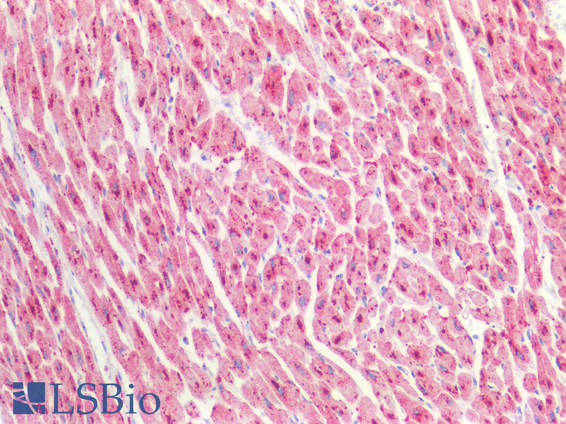 CTSD / Cathepsin D Antibody - Human Heart: Formalin-Fixed, Paraffin-Embedded (FFPE)