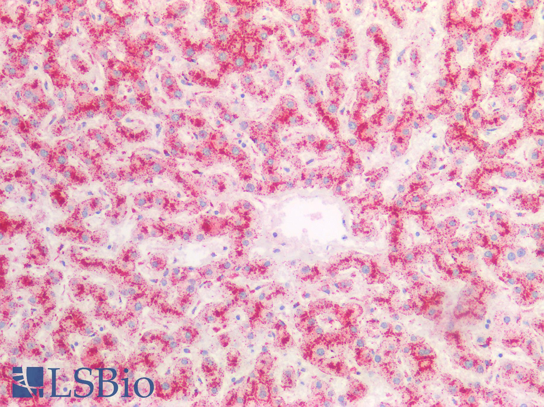 CTSD / Cathepsin D Antibody - Human Liver: Formalin-Fixed, Paraffin-Embedded (FFPE)