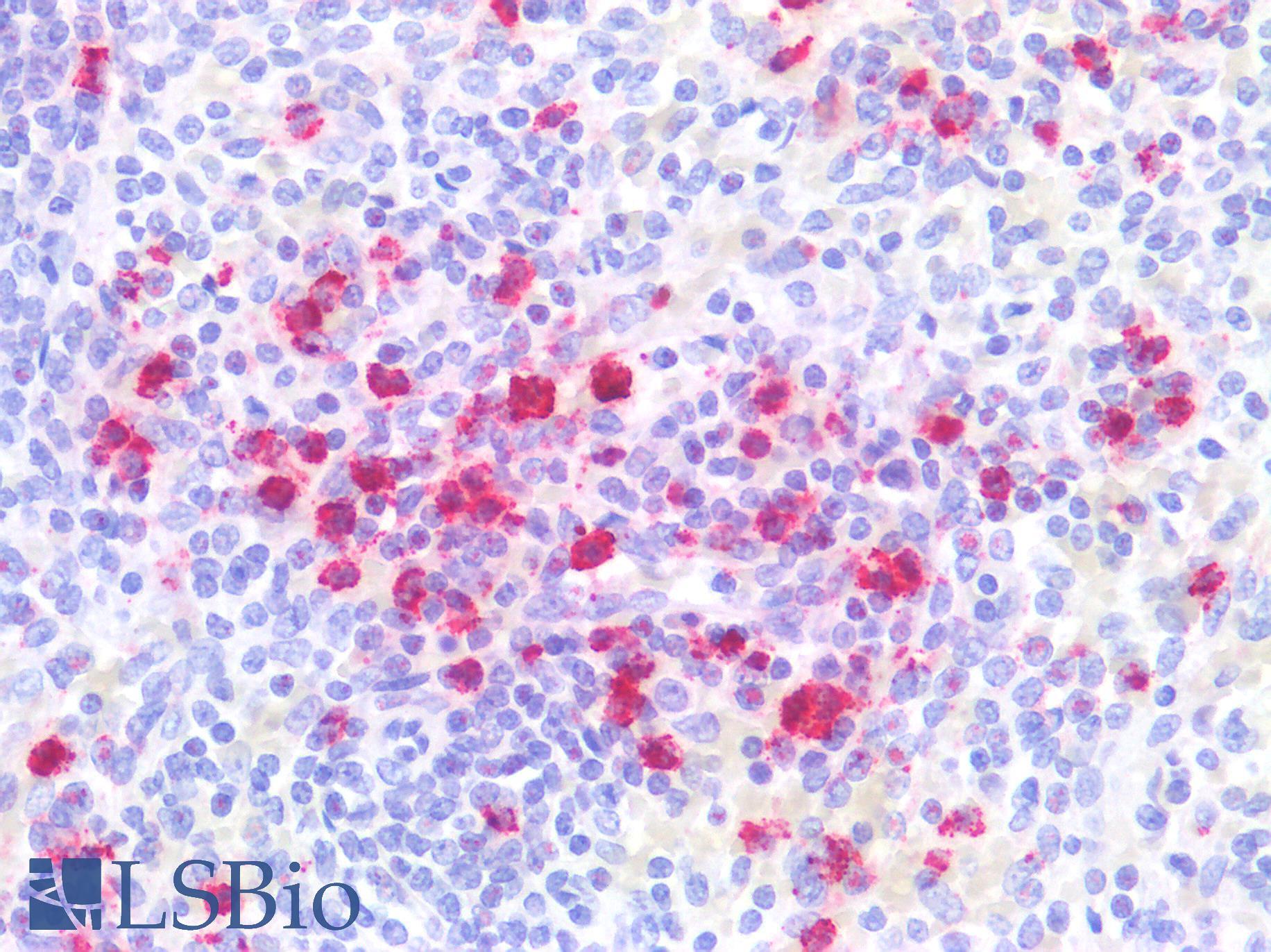 CTSG / Cathepsin G Antibody - Human Spleen: Formalin-Fixed, Paraffin-Embedded (FFPE)