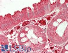 CTSS / Cathepsin S Antibody - Human Colon: Formalin-Fixed, Paraffin-Embedded (FFPE)