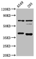 CTSS / Cathepsin S Antibody - Western Blot Positive WB detected in: A549 whole cell lysate, 293 whole cell lysate All lanes: CTSS antibody at 1:4000 Secondary Goat polyclonal to rabbit IgG at 1/50000 dilution Predicted band size: 38 kDa Observed band size: 38 kDa