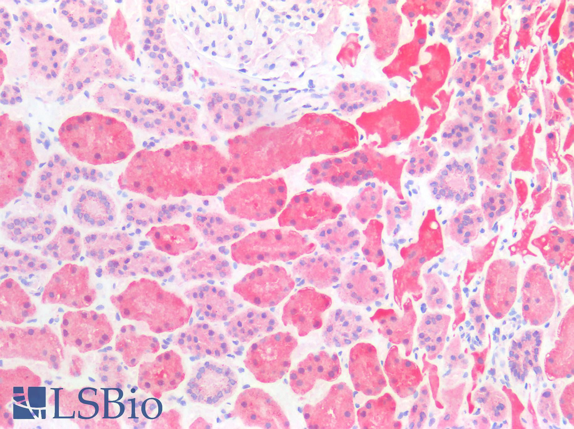 CTSS / Cathepsin S Antibody - Human Kidney: Formalin-Fixed, Paraffin-Embedded (FFPE)
