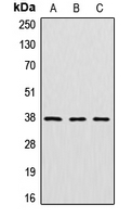 CTSV / Cathepsin V Antibody - Western blot analysis of Cathepsin V expression in HeLa (A); mouse kidney (B); rat kidney (C) whole cell lysates.