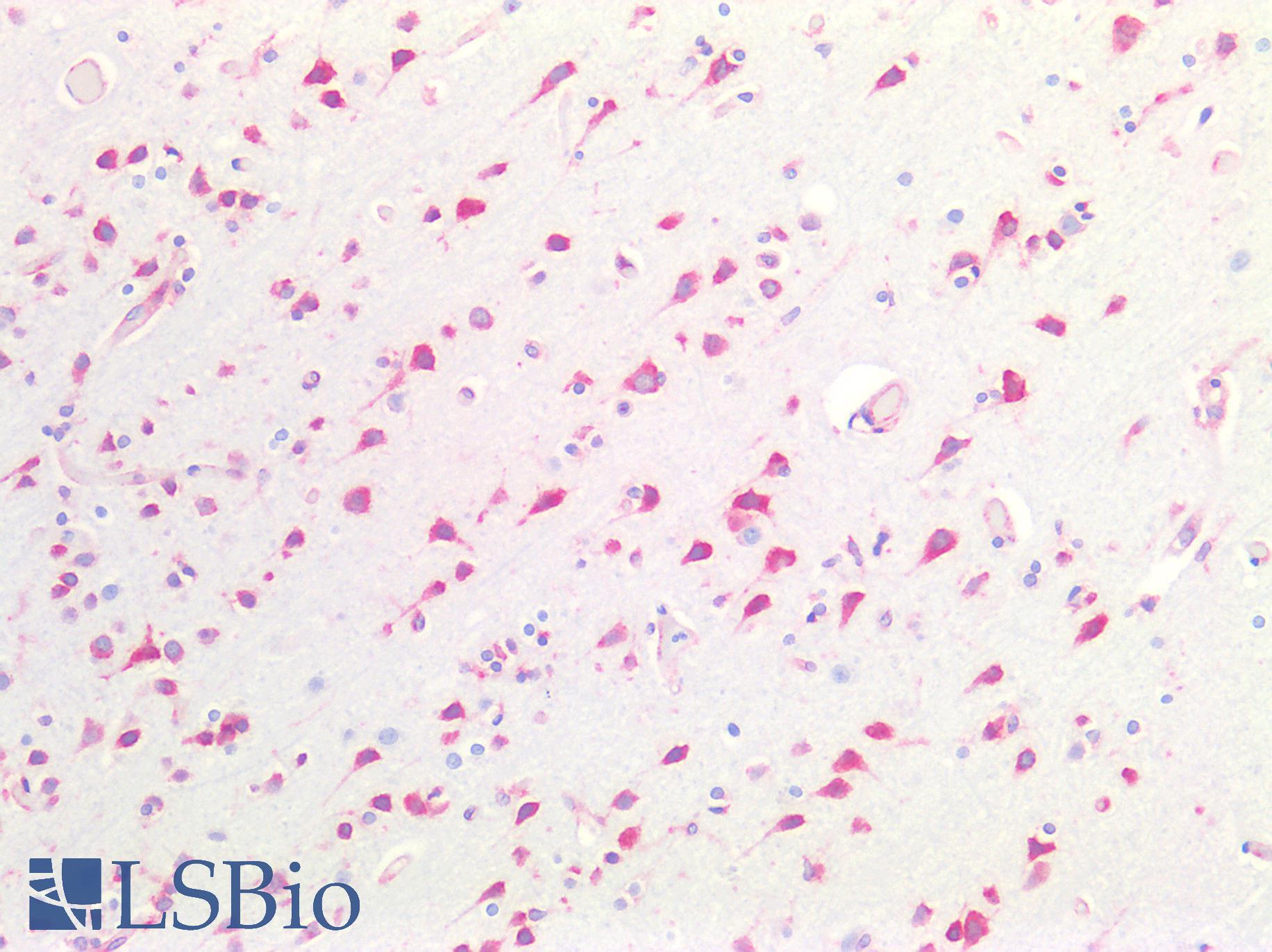 CTSV / Cathepsin V Antibody - Human Brain, Cortex: Formalin-Fixed, Paraffin-Embedded (FFPE)