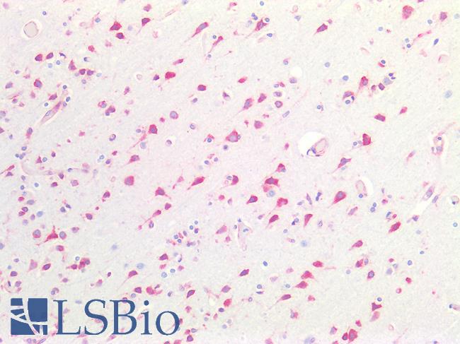 CTSV / Cathepsin V Antibody - Human Brain, Cortex: Formalin-Fixed, Paraffin-Embedded (FFPE)