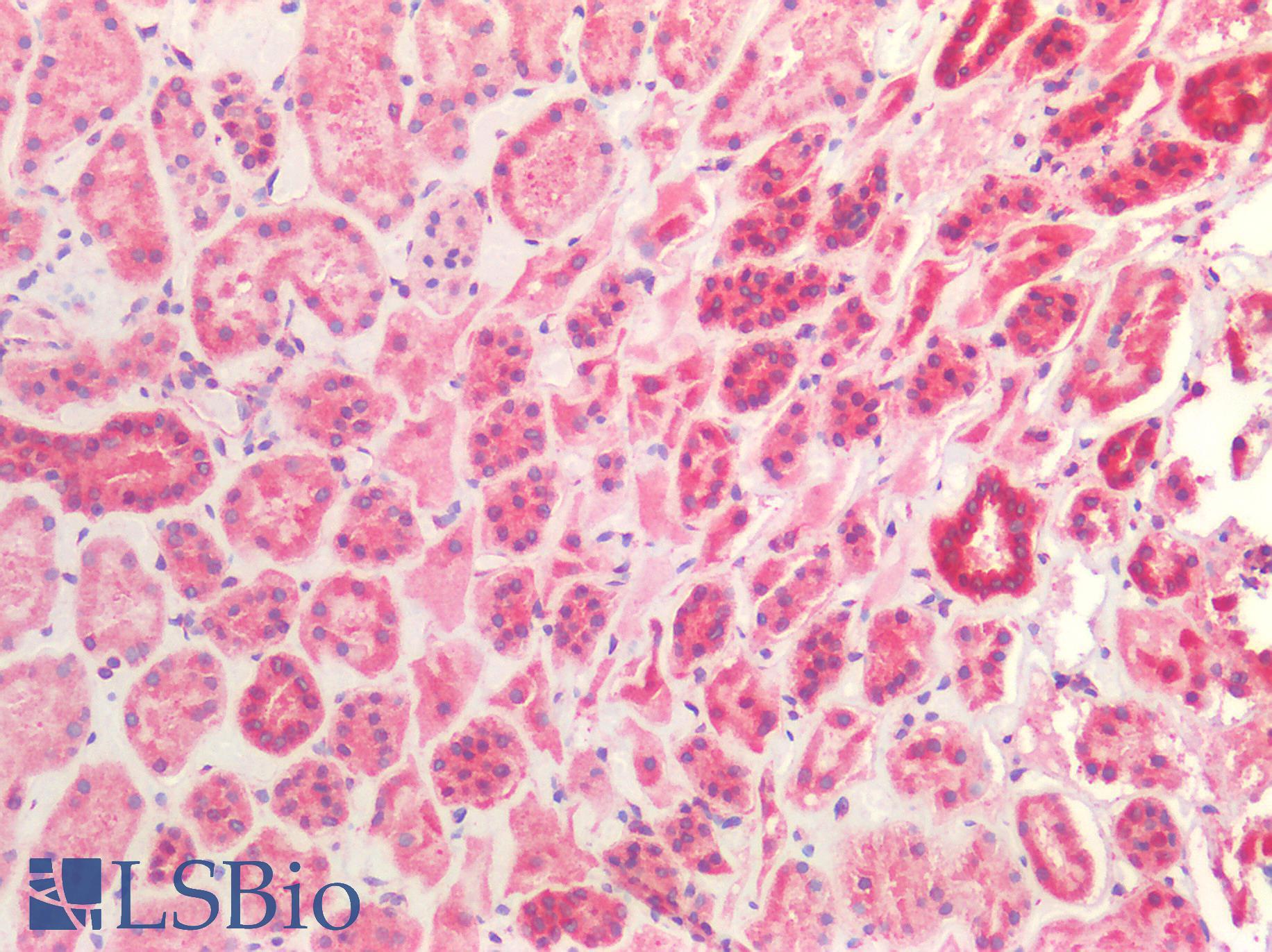 CTSV / Cathepsin V Antibody - Human Kidney: Formalin-Fixed, Paraffin-Embedded (FFPE)