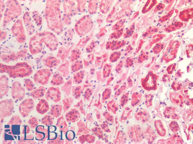 CTSV / Cathepsin V Antibody - Human Kidney: Formalin-Fixed, Paraffin-Embedded (FFPE)