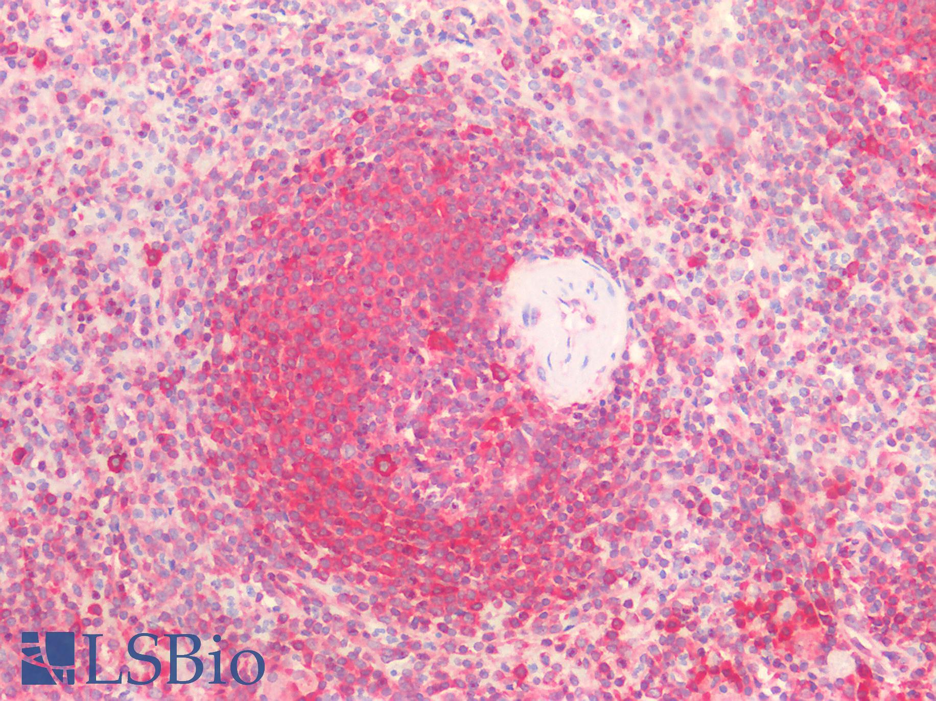 CTSV / Cathepsin V Antibody - Human Spleen: Formalin-Fixed, Paraffin-Embedded (FFPE)