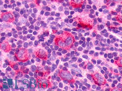 CX3CR1 Antibody - Lymph node, Hodgkin's lymphoma