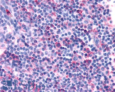 CXCR3 Antibody - Tonsil, lymphocytes and dendritic cells
