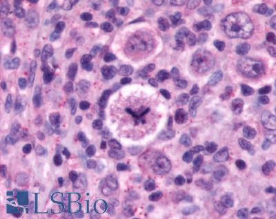 CXCR4 Antibody - lymph node, Hodgkin's lymphoma
