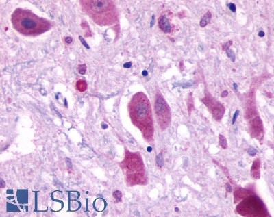 CXCR4 Antibody - Brain Parkinson's Disease Nonpigmented Neurons