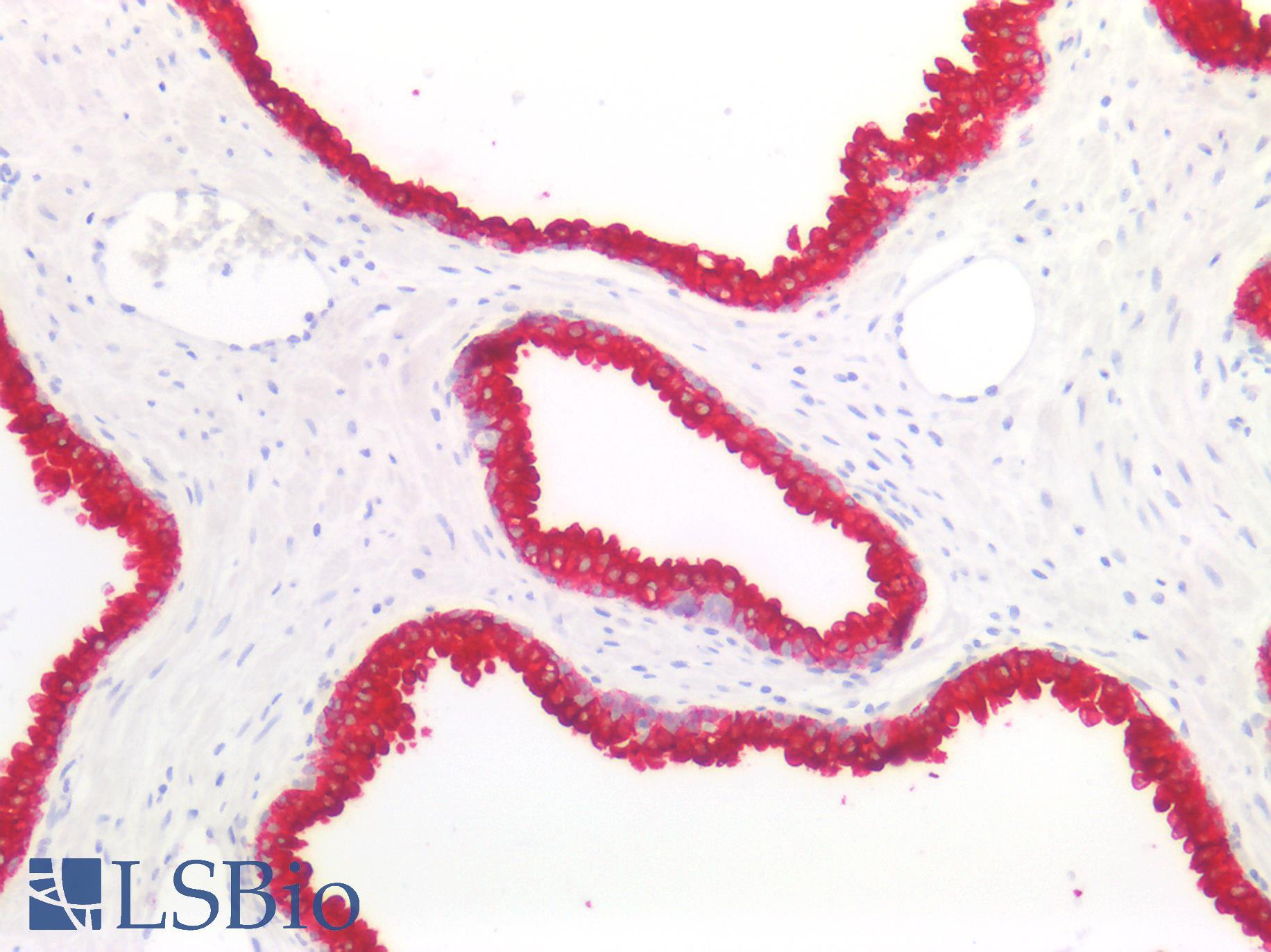 Cytokeratin 8+18 Antibody - Human Prostate: Formalin-Fixed, Paraffin-Embedded (FFPE)