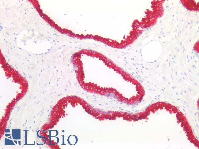 Cytokeratin 8+18 Antibody - Human Prostate: Formalin-Fixed, Paraffin-Embedded (FFPE)