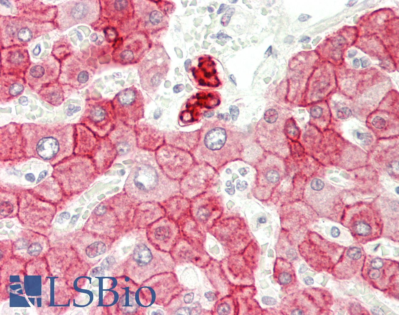 Cytokeratin 8+18 Antibody - Human Liver: Formalin-Fixed, Paraffin-Embedded (FFPE) This image was taken for the unconjugated form of this product. Other forms have not been tested.