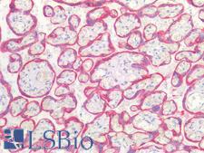Cytokeratin AE1+AE3 Antibody - Human Placenta: Formalin-Fixed, Paraffin-Embedded (FFPE)