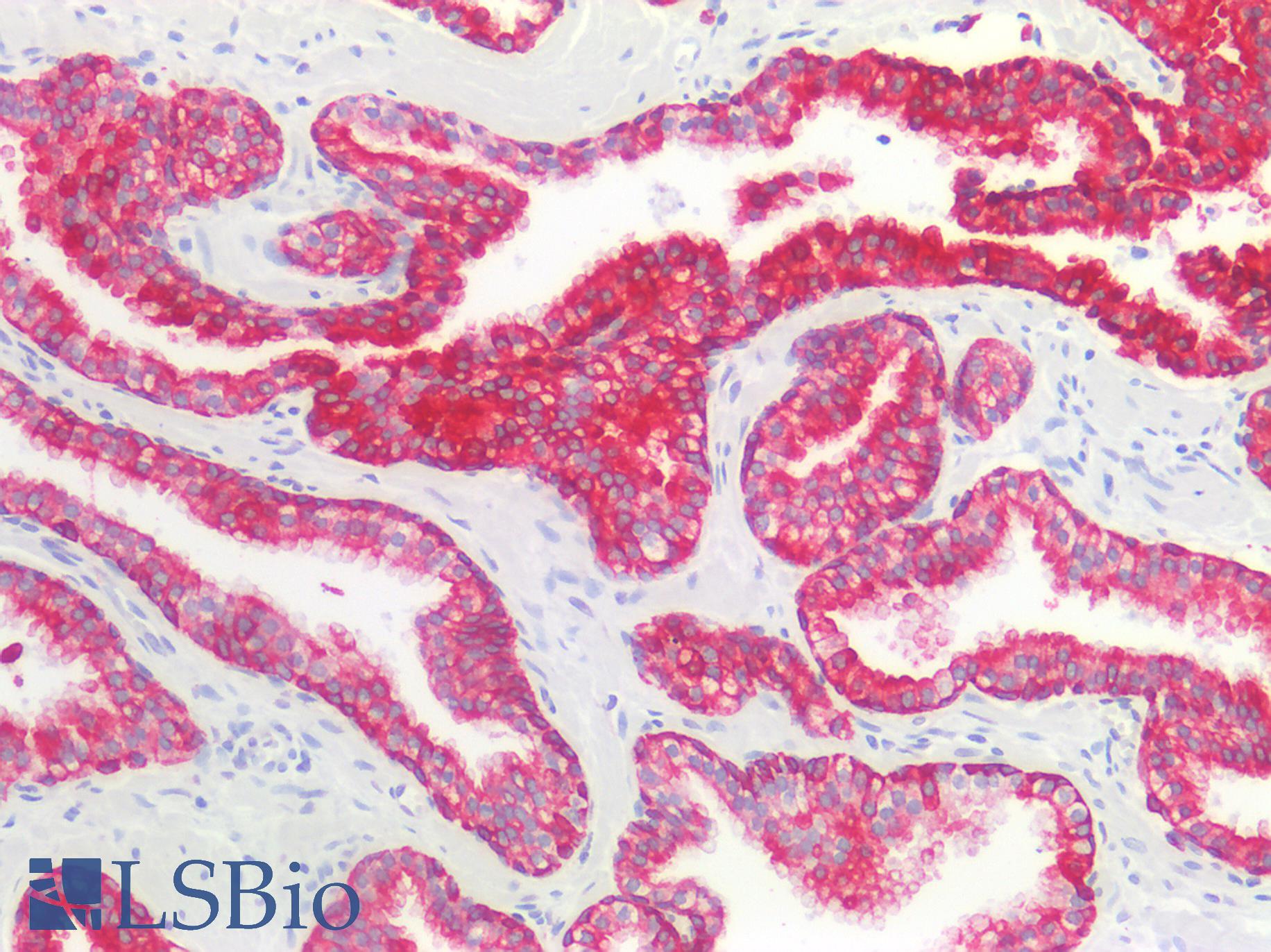 Cytokeratin AE1+AE3 Antibody - Human Prostate: Formalin-Fixed, Paraffin-Embedded (FFPE)