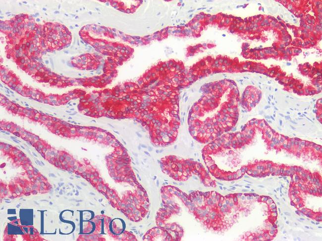 Cytokeratin AE1+AE3 Antibody - Human Prostate: Formalin-Fixed, Paraffin-Embedded (FFPE)