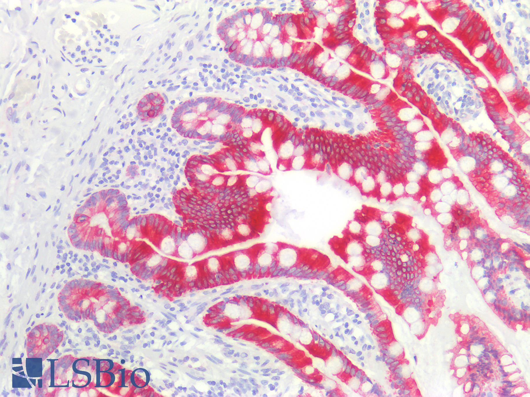 Cytokeratin AE1+AE3 Antibody - Human Small Intestine: Formalin-Fixed, Paraffin-Embedded (FFPE)