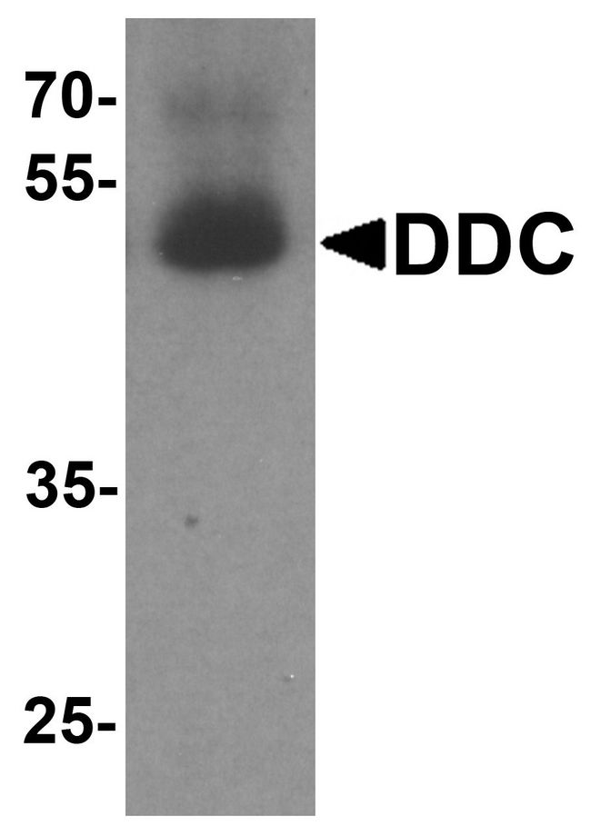 DDC / DOPA Decarboxylase Antibody - Western blot analysis of DDC in human lung tissue lysate with DDC antibody at 1 ug/ml.