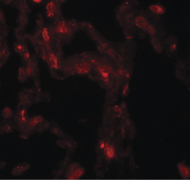 DDC / DOPA Decarboxylase Antibody - Immunofluorescence of DDC in human lung tissue with DDC antibody at 20 ug/ml.