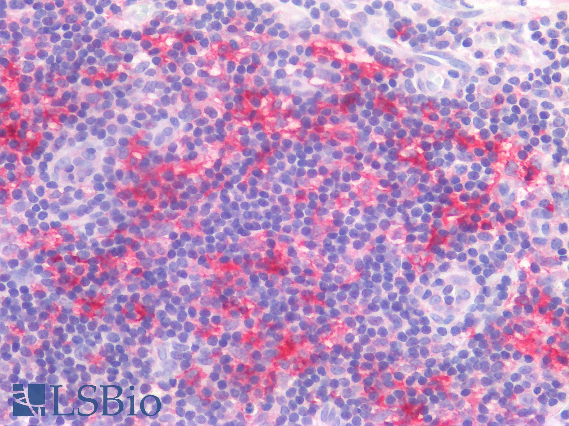 DEC-205 / CD205 / LY75 Antibody - Human Tonsil: Formalin-Fixed, Paraffin-Embedded (FFPE)
