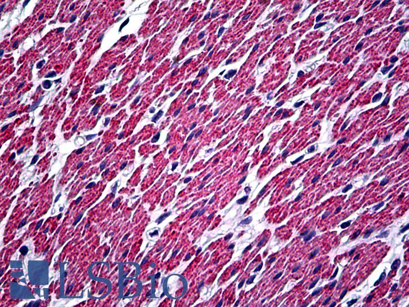 DES / Desmin Antibody - Anti-DES / Desmin antibody IHC of human colon, smooth muscle. Immunohistochemistry of formalin-fixed, paraffin-embedded tissue after heat-induced antigen retrieval. Antibody dilution 1:100.