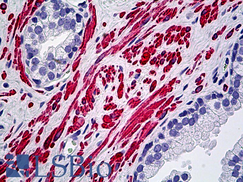 DES / Desmin Antibody - Anti-DES / Desmin antibody IHC of human prostate, smooth muscle. Immunohistochemistry of formalin-fixed, paraffin-embedded tissue after heat-induced antigen retrieval. Antibody dilution 1:100.