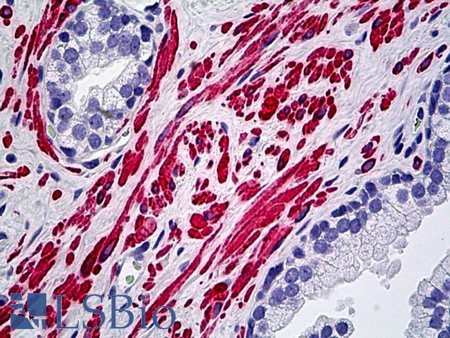 DES / Desmin Antibody - Anti-DES / Desmin antibody IHC of human prostate, smooth muscle. Immunohistochemistry of formalin-fixed, paraffin-embedded tissue after heat-induced antigen retrieval. Antibody dilution 1:100.