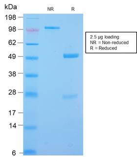 DES / Desmin Antibody - SDS-PAGE Analysis Purified Desmin Rabbit Recombinant Monoclonal Antibody (DES/2960R). Confirmation of Purity and Integrity of Antibody.