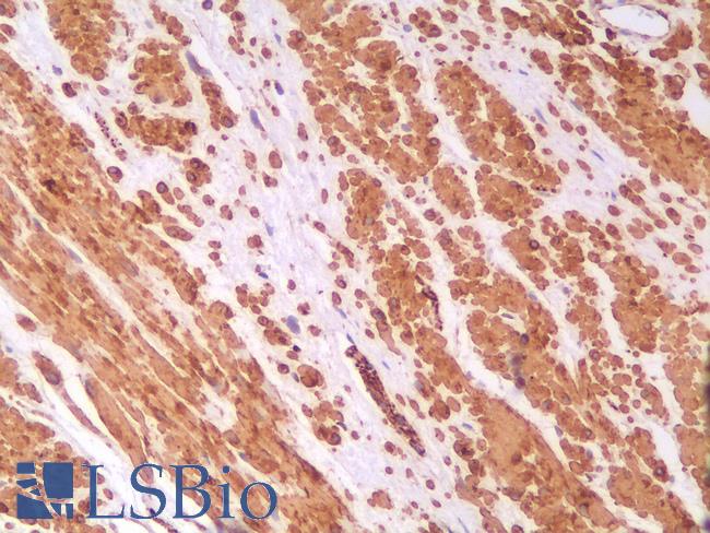 DES / Desmin Antibody - Human Prostate: Formalin-Fixed, Paraffin-Embedded (FFPE)
