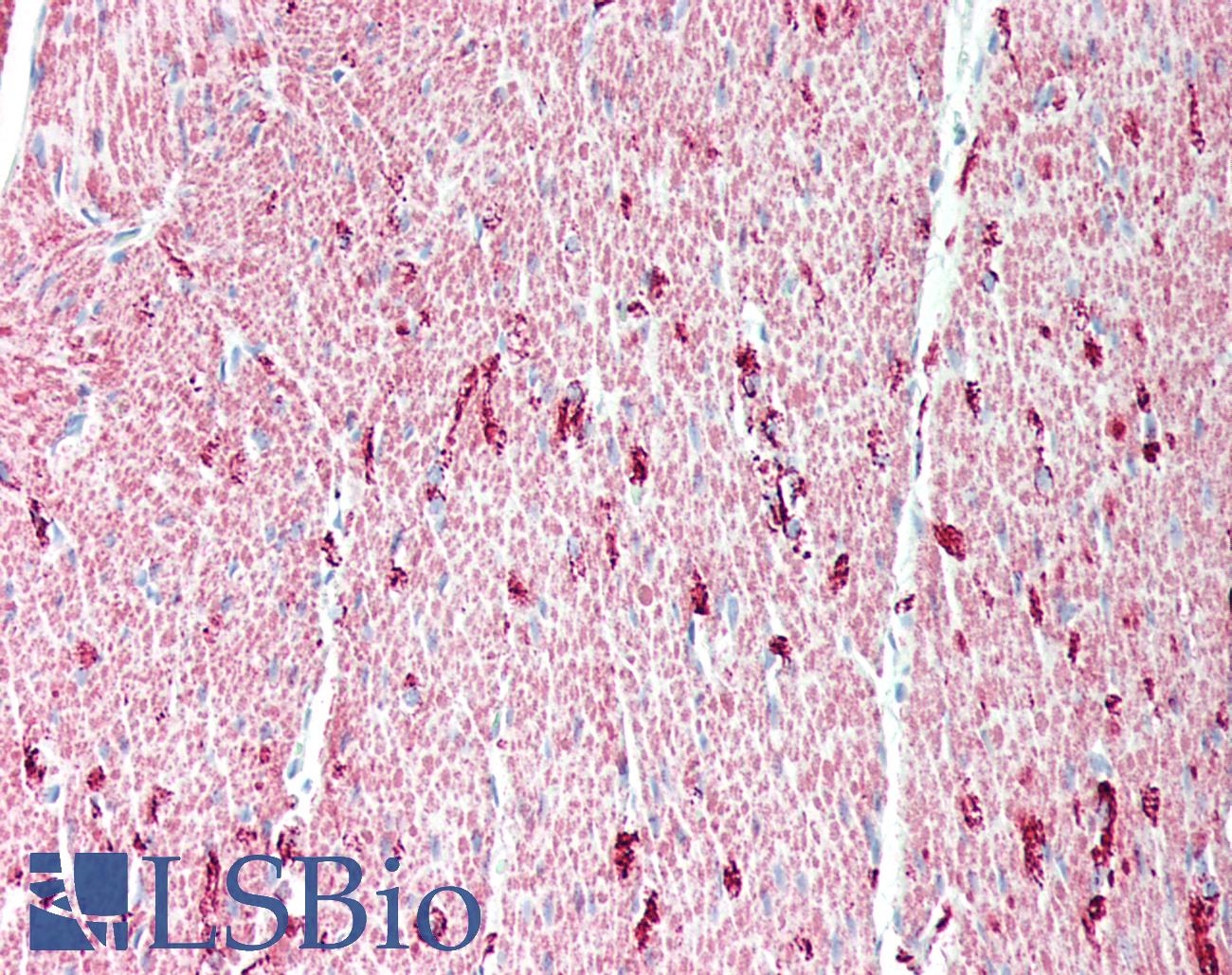 DES / Desmin Antibody - Human colon, smooth muscle: Formalin-Fixed, Paraffin-Embedded (FFPE)